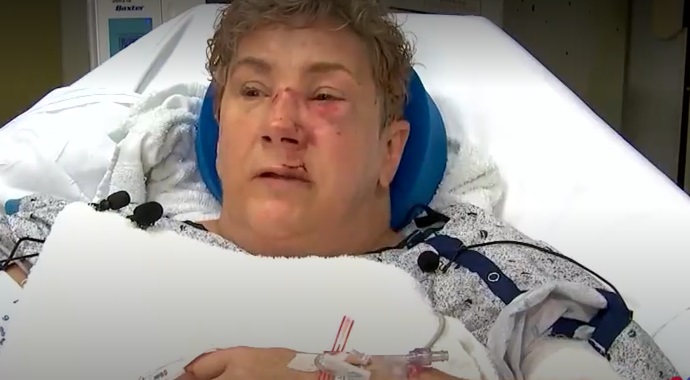 Woman attacked by bear in her yard lives to talk about it