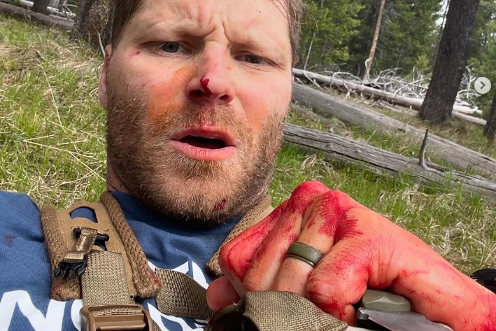Can of Bear Spray Saves Man’s Life During Grizzly Attack