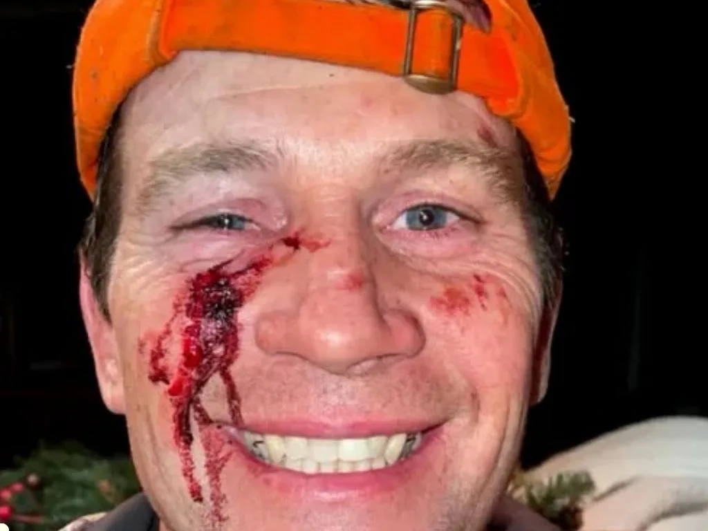 Hunt Ends in Close Call With Wounded Deer