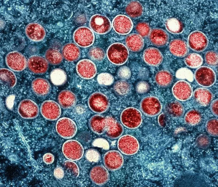 Feds charge foreign nationals working at the National Institutes of Health with smuggling monkeypox into the United States and lying about it